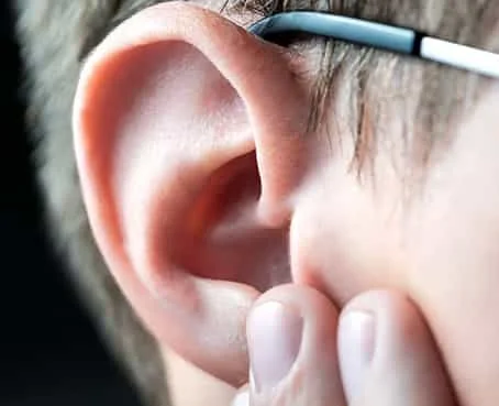 Prominent Ear Correction